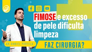 Fimose e excesso de pele dificulta limpeza: faz cirurgia?