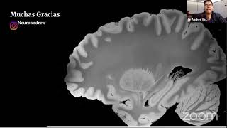 3° Congreso Nacional de Neurociencias "Ayudar a prevenir el deterioro cognitivo" AANS & AMEP