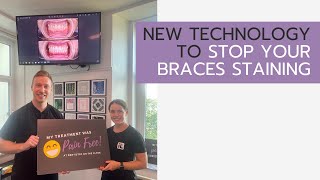 New Technology To Stop Your Braces Staining