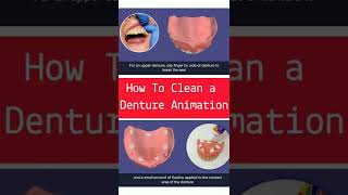 #shorts Aged People Must Watch || How To Clean a Denture | Patient Education Series