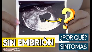 Síntomas y Causas de un EMBARAZO ANEMBRIONARIO 😯🤰