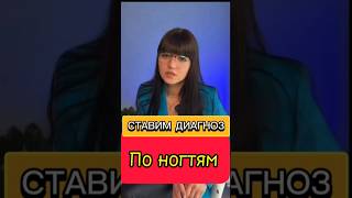 Ставим диагноз по ногтям #siberianwellness #здоровьесемьи #иммунитет#личныйбренд