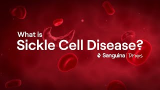 What is Sickle Cell Disease? | #SanguinaDrops