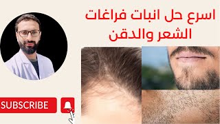 الطريقة السرية و الفعالة في انبات فراغات الشعر و اللحية