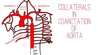 Collateral Circulation in Coarctation of Aorta | Made Easy