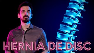 TUNCAY OZTURK: DISC HERNIA. CAUSES. SYMPTOMS. TREATMENT.