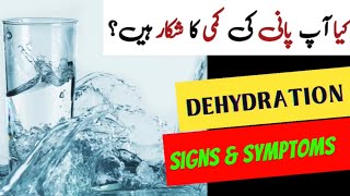 Dehydration | Signs and Symptoms of Dehydration |