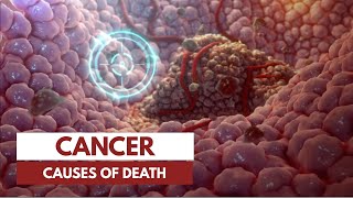 How does a person die from cancer? | 3D Animation