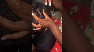 Scalp Scratching | Fast Scratching | ￼Flaky Scalp #naturalhair #dandruffremoval #itchyscalp