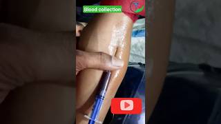 Blood collection technique #shortvideo #youtubeshorts #viral #motivation #viral #trendingshorts #new