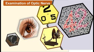 Examination of  optic nerve