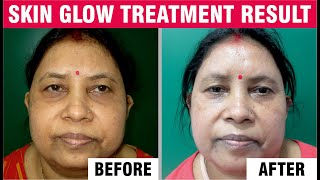 Best Clinic for Skin Glow treatments | Professional Skin Glow treatments | Sakhiya Skin Clinic