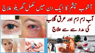 ashob e chashm ka ilaj in urdu | Ashob E Chashm Treatment in Urdu/Hindi | Eyes Infection in Karachi