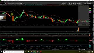 Options Small Account Challenge Day 3