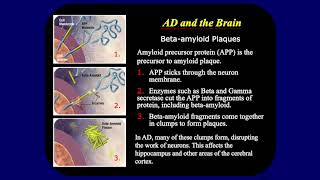 Center for Prevention and Treatment of Neurodegenerative Diseases