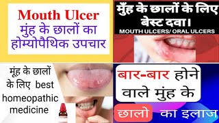 Mouth ulcer  Best Homoeopathic Medicine //मुंह के छाले तुरंत ठीक हो जाएंगे//HM4U Roorkee//By: Y.K