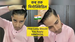 मिनॉक्सिदिल Max. Results| How long to leave| Apply Minoxidil| Receding hairline| Best Regrowth|Hindi