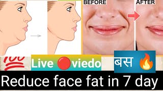 Anvi. Facial yoga exercise किसको करना है,आ जाओ सब 👍🏽