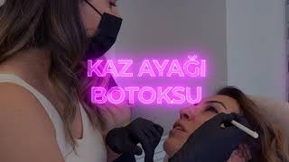 Kaz Ayağı Botoksu | Uzm. Dr. Dilek Destegül