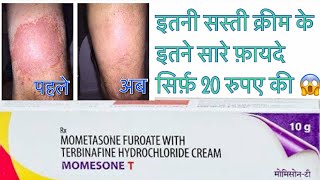 Momesone-T क्रीम 😱 इतनी सस्ती सिर्फ़ 20 रुपए की एलर्जी दाद के लिए  हिन्दी में#skincare #momesone t