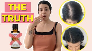 NATURAL TREATMENTS THAT WORK FOR HAIR LOSS (backed by science) | The TRUTH | Female Hair Loss