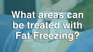 What areas can be treated with Fat Freezing? | The Body Clinic | Fat Freezing FAQ ❄️