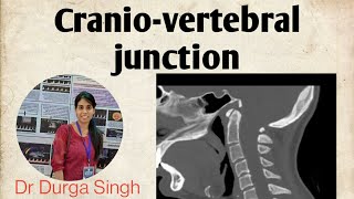 Cranio-vertebral junction- Anatomy and Radiology