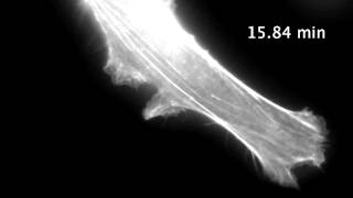 F-actin dynamics reported by F-Tractin