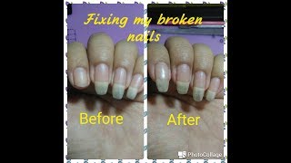 Fixing my broken nails