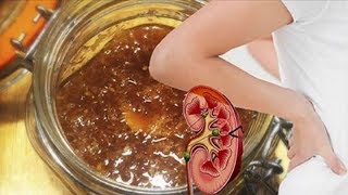 2 Teaspoons Of This Ancient Remedy And Say Goodbye To Gastritis, Constipation And Kidney Stones!