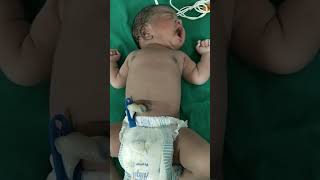 imeediately after birth#newborn baby##trendingshorts #newstatus #subscribe my channel 👍👍👍👍👍