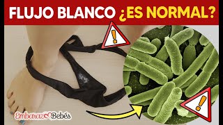 😳 FLUJO BLANCO en el Embarazo ¿ES NORMAL?