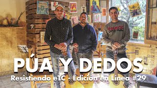 Resistiendo eTC - Edición en Línea #29 | Púa y dedos