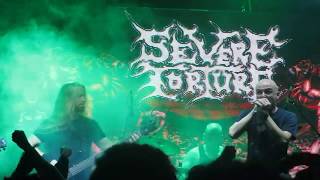 SEVERE TORTURE  - Grave Condition + Unholy Misconception [LIVE] Bogotá