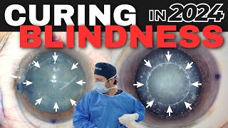 Curing Blindness - Full Surgery