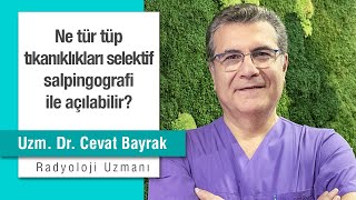 Ne tür tüp tıkanıklıkları selektif salpingografi ile açılabilir?