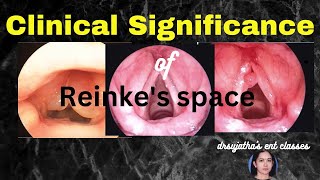 206.Importance of Reinke's Space  #reinke's space #vocalfolds #clinicalexamination