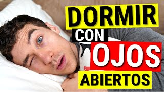 Dormir con los ojos abiertos   Tratamientos de ojo seco para lagoftalmos