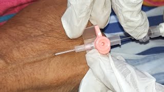 VeinFlon Tricks | How To Give Cannula | Live Procedure | Dr Tusar 2.0