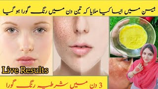 Besan Face Pack For Glowing Skin | Face Pack for whitening | Gram Flour Skin Whitening Face Pack