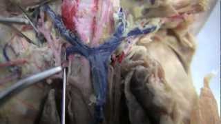 Cat Dissection - blood vessels 3 (HD video, good, see description for note)