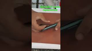 REALME7i COMBO REPLACEMENT #realme #displaytouch #combo #short #shortvideo #realme7i