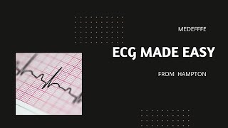 ECG a very simplified and conceptual approach from hampton. part 2