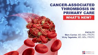 Cancer-associated Thrombosis: What's New for Primary Care Jan 11