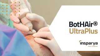 BotHair® Ultra Plus: tecnologia propria del Gruppo Insparya