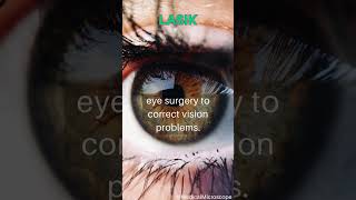 LASIK │ Selected medical terminology │ #medicalterminology #lasik #short