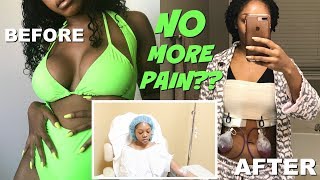 THE TRUTH ABOUT BREAST IMPLANTS | MY EXPLANT SURGERY EXPERIENCE VLOG | Breast Implant Illness