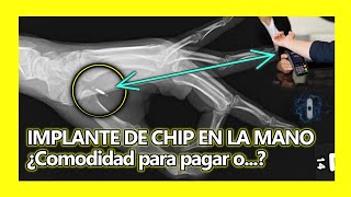 🖐️ "IMPLANTE DE CHIP" en tú MANO te permite 💲pagar SIN 💰efectivo o 💳tarjeta alguna.