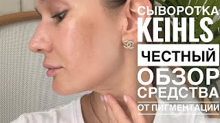 Обзор сыворотки от ПИГМЕНТНЫХ ПЯТЕН Kiehls dark spot solution