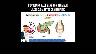 Consuming Aloe Vera for stomach ulcers, diabetes or arthritis #aloevera #stomachulcer #diabetes